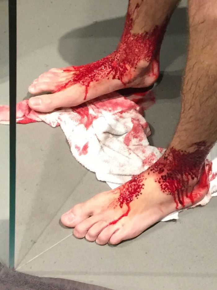 Bloody-ankles-2.jpg