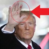 Donald Trump's health mystery goes viral..!? (strange pic)