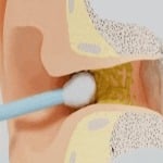 Hidden cause of tinnitus discovered? (Nothing to do with your ears or hearing)